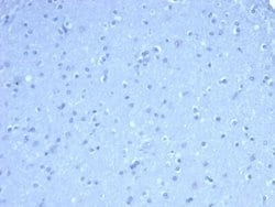 TOM1L1 Antibody (TOM1L1/4690) - Azide and BSA Free, Novus Biologicals 100